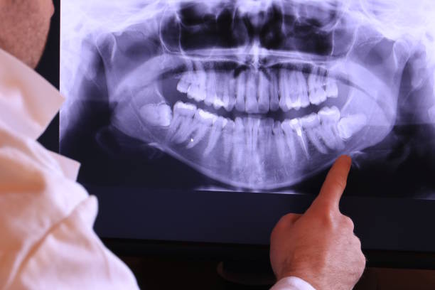 Best Emergency Dental Services for Seniors in Grill, PA