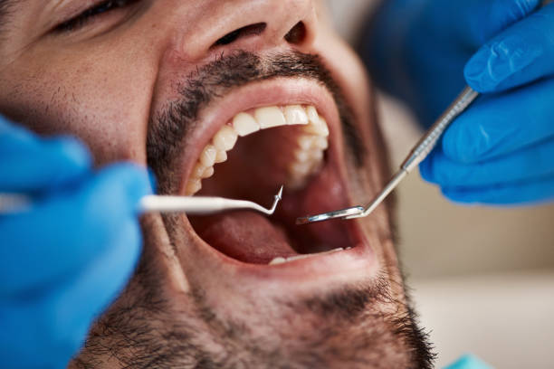 Best Weekend Emergency Dentist in Grill, PA
