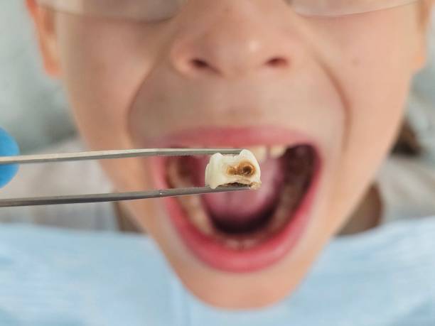 Best Orthodontic Emergency Dentist in Grill, PA